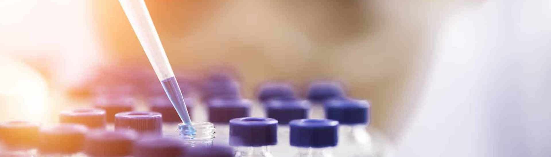 Labowerkt met hormonene: over hormoonverstoorders